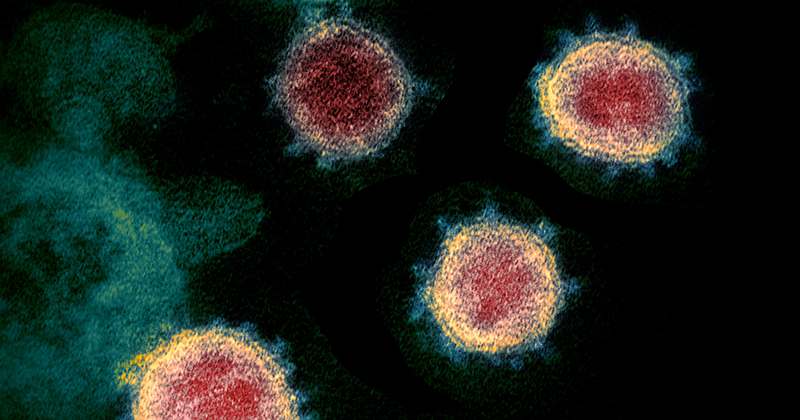 Tecnologia que sequenciou coronavírus em 48 horas permitirá monitorar epidemia em tempo real